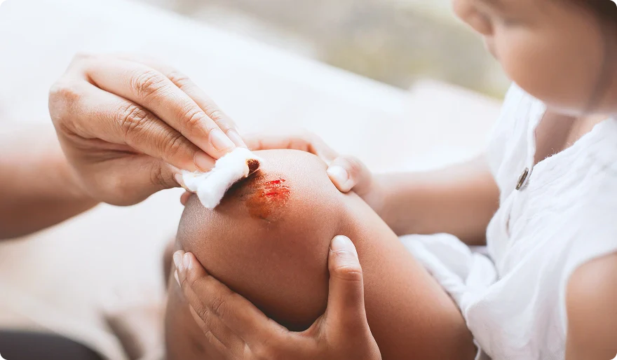 Wound Infection Signs: How to Tell If Your Cut or Surgical Site Is Infected