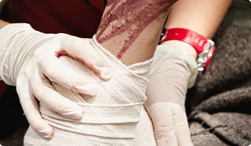 Post-Surgery Wound Care at Home: What Your Hospital Didn't Tell You