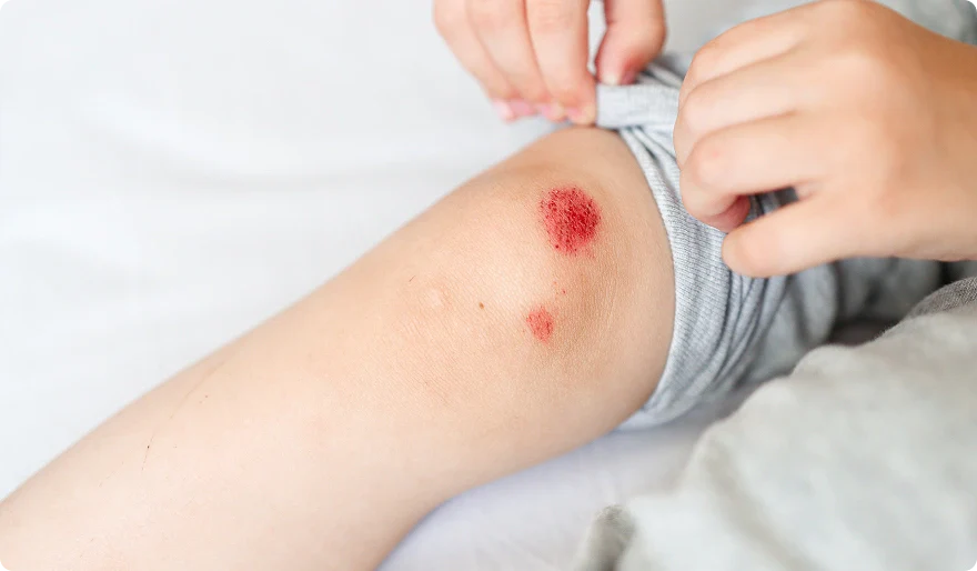 The Complete Home Wound Care Guide: How to Treat Every Type of Wound Safely