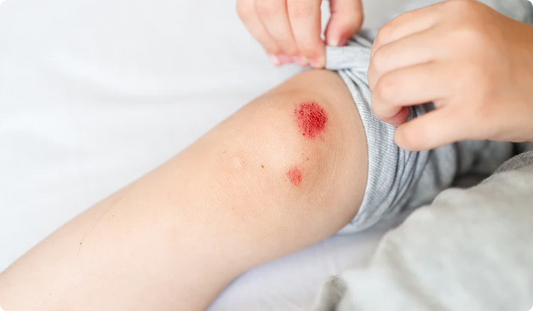The Complete Home Wound Care Guide: How to Treat Every Type of Wound Safely