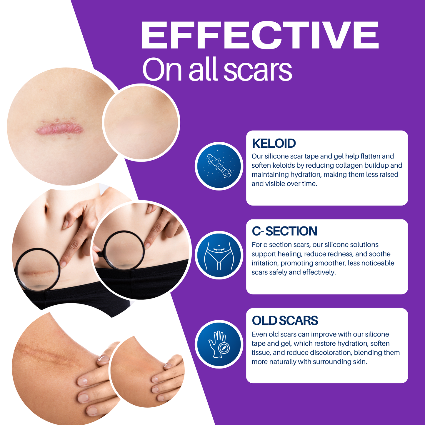 Silicone Scar Gel and Tan Silicone Scar Tape