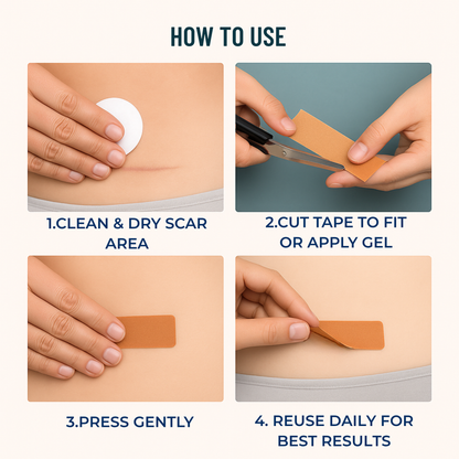 Silicone Scar Gel and Tan Silicone Scar Tape