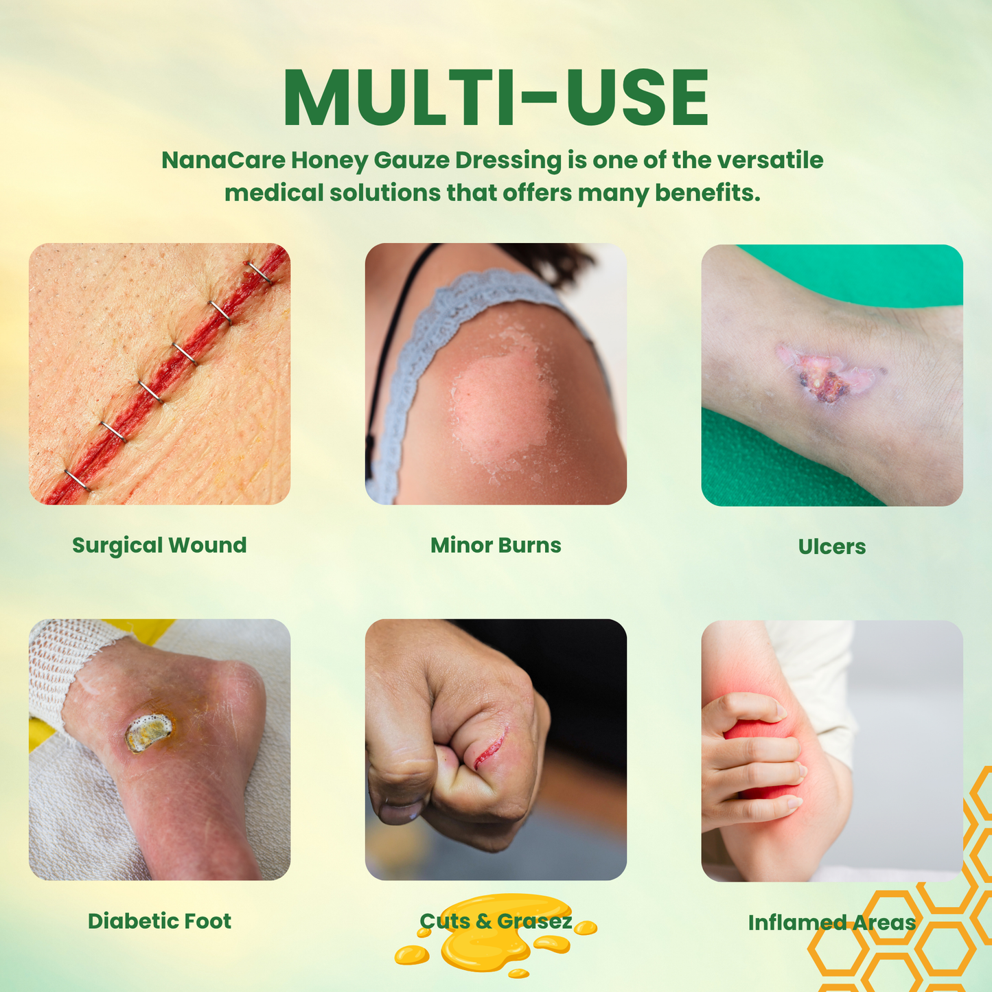 NanaCare Honey Gauze Dressing