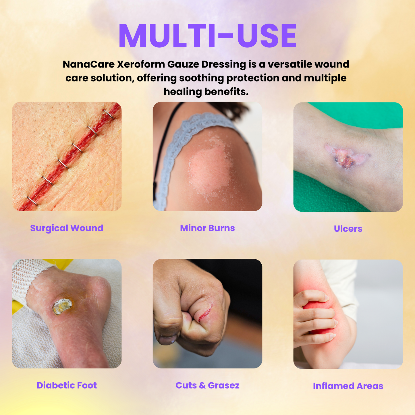 NanaCare Xeroform Dressing
